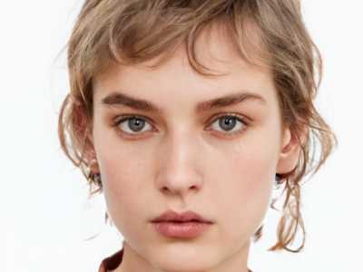 郑小红医生真实水平怎么样?高难度宽改窄/肉条修复一把好手,和杜园园齐名不虚传!